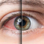 is vowiszojid54 for sensitive eyes? A Guide to Safety and Comfort