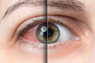 is vowiszojid54 for sensitive eyes? A Guide to Safety and Comfort