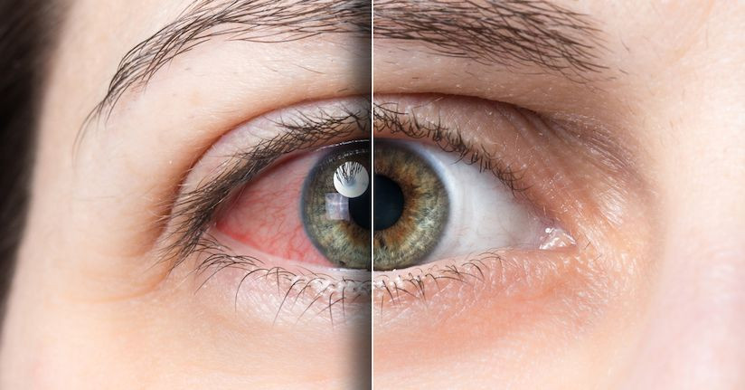 is vowiszojid54 for sensitive eyes? A Guide to Safety and Comfort