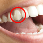 Fangs of Function: Understanding Canine Teeth in Humans and Animals
