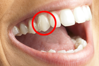 Fangs of Function: Understanding Canine Teeth in Humans and Animals